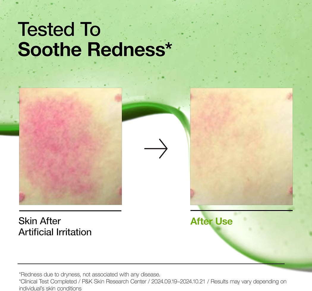 Anua 10+ AZELAIC ACID 10 + HYALURON REDNESS SOOTHING SERUM ANUA SERUM APAISANT ROUGEURS AZELAIC ACIDE 10 HYALURONIQUE 30 ML 1.01 FL. OZ