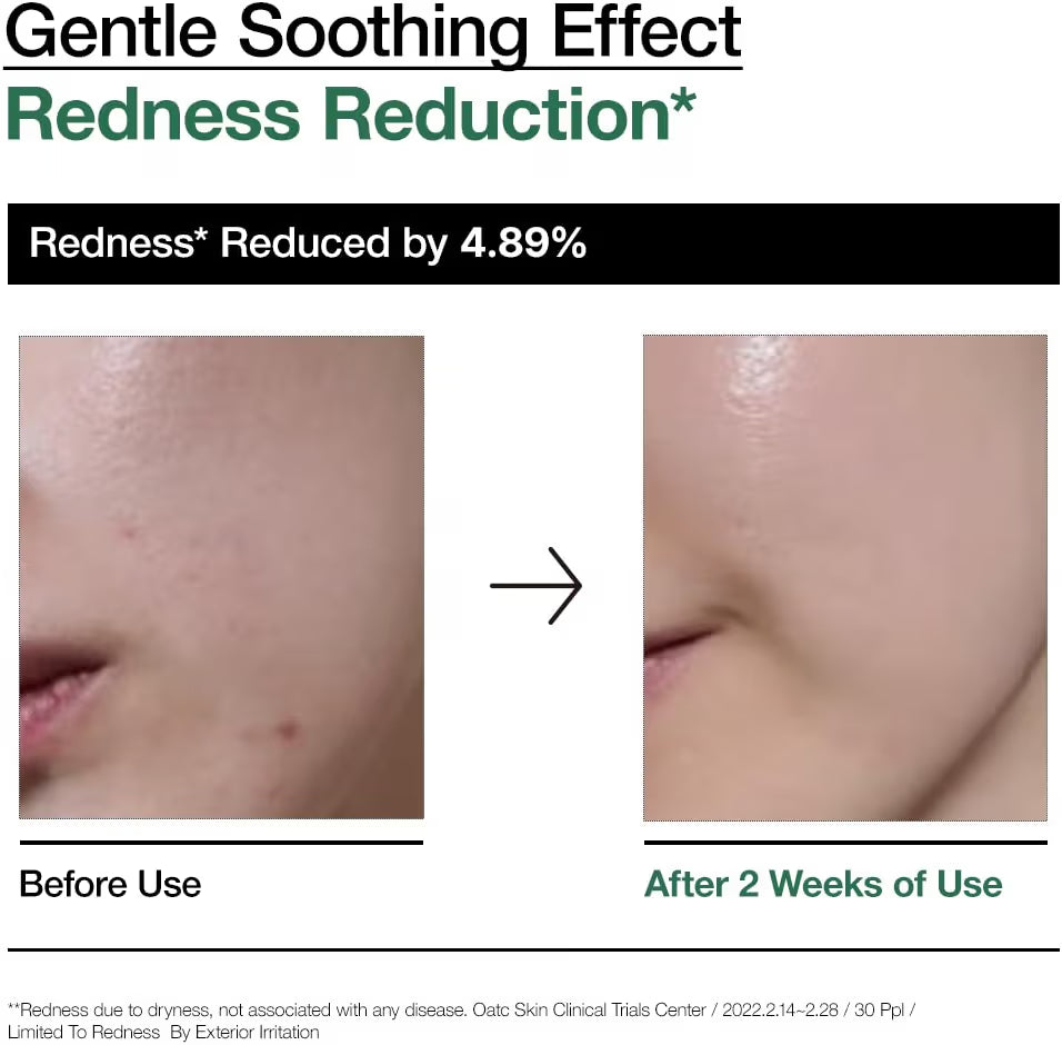 ANUA Korendy Heartleaf 80% Moisture Ampoule - Moisturizing, Brightening 30ml Concentrated Ampoule