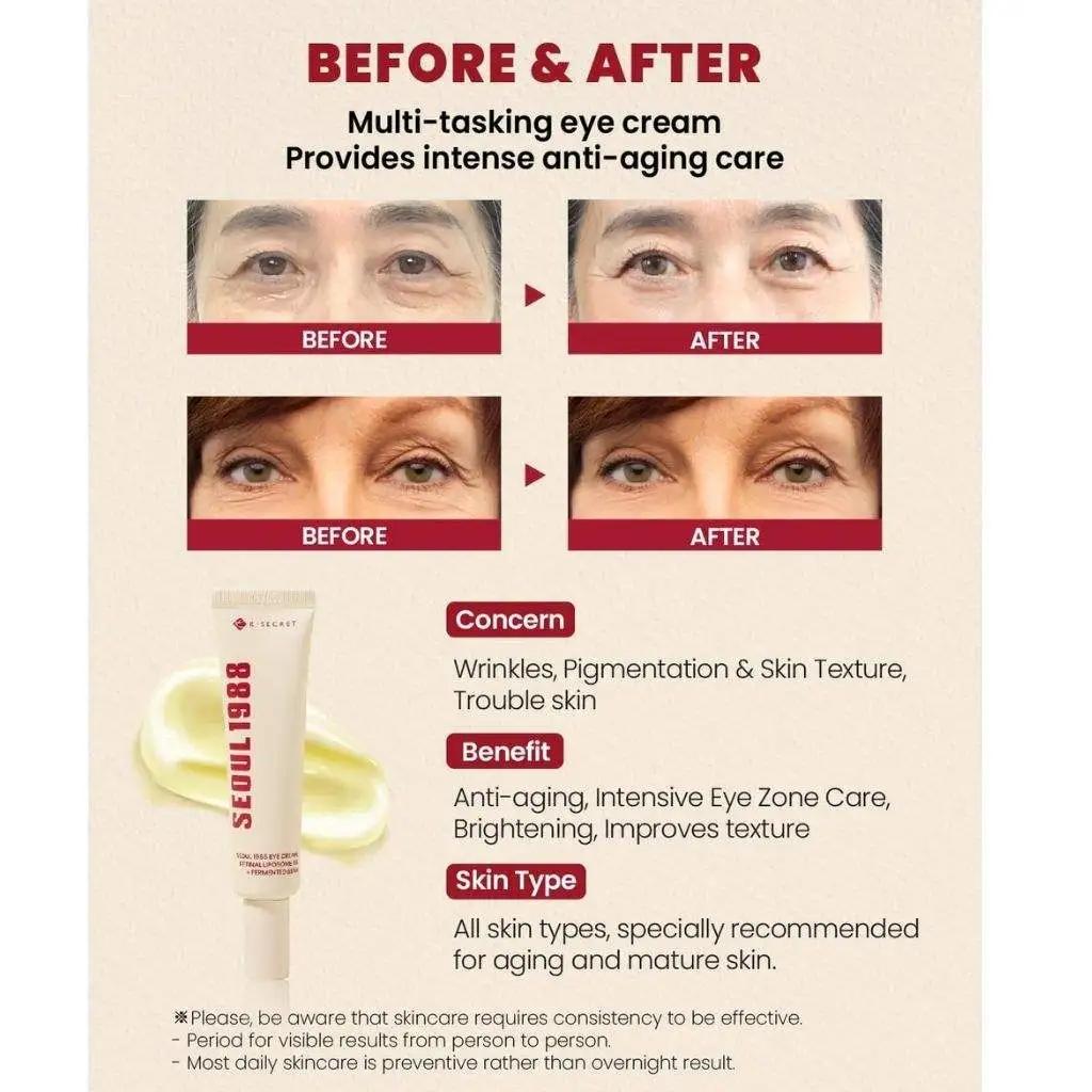 SEOUL 1988 Eye Cream Retinal Liposome 4%+fermented Bean 30ml